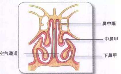 鼻中隔偏曲的症状