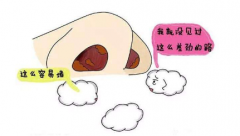 重庆鼻科医院-鼻息肉的病因有哪些？