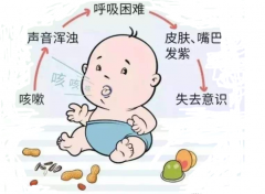 重庆鼻科医院哪个好？鼻腔异物怎么取出来？